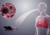 Mengenal Virus Hanta, Bahaya Virus dari Kotoran Tikus